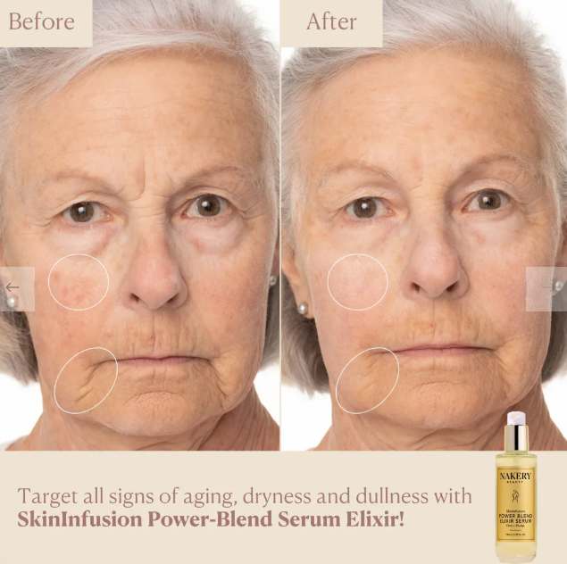 Nakery SkinInfusion Power-Blend Serum Elixir - 5.07oz