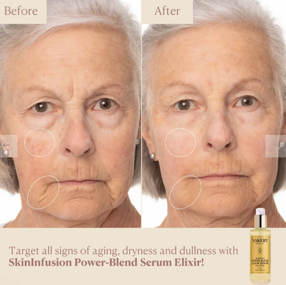Nakery SkinInfusion Power-Blend Serum Elixir - 5.07oz