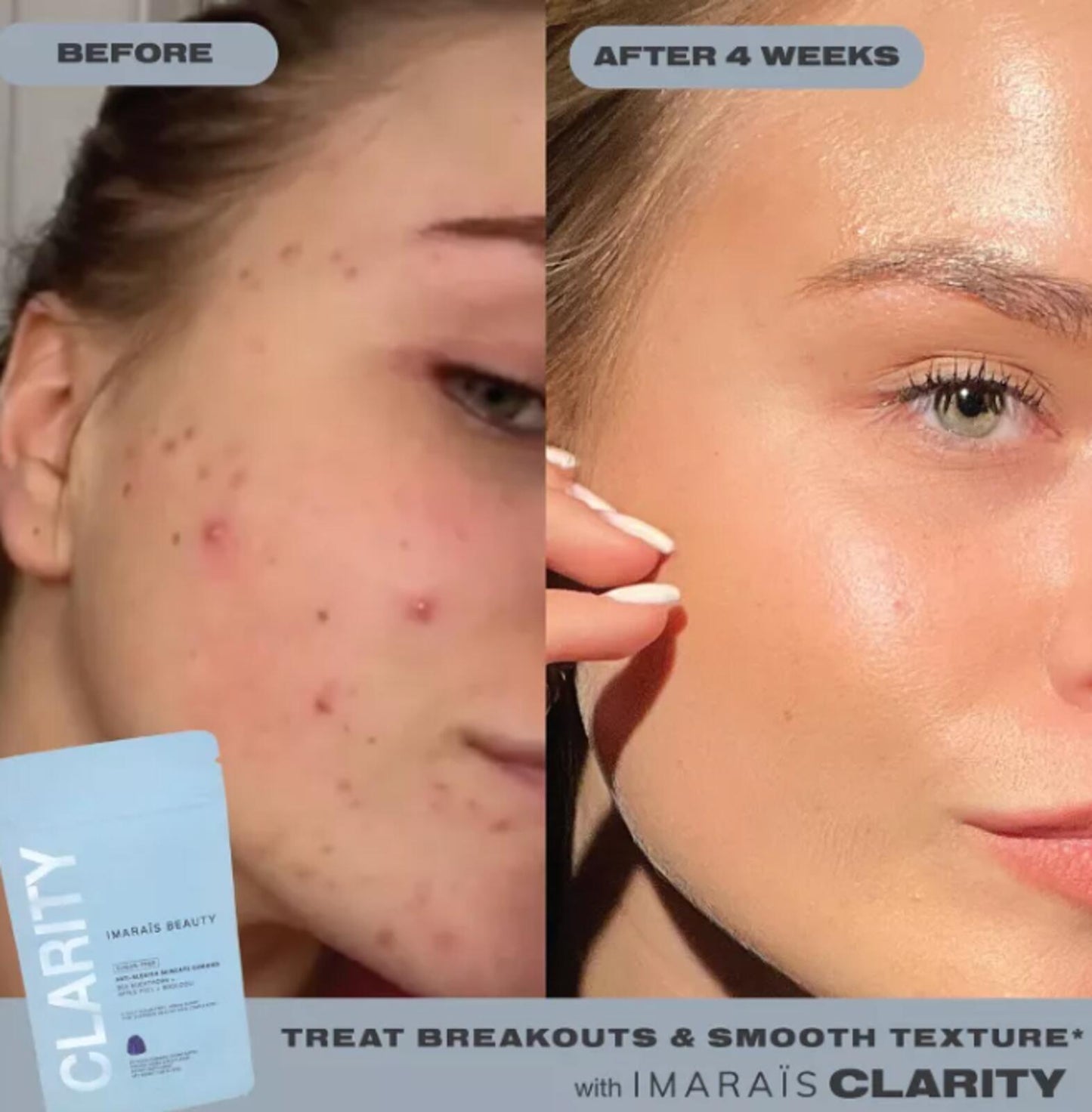 Imarais Beauty Clarity Anti-Blemish Gummies for Clear Complexion - Vegan and Sugar-Free - 30ct
