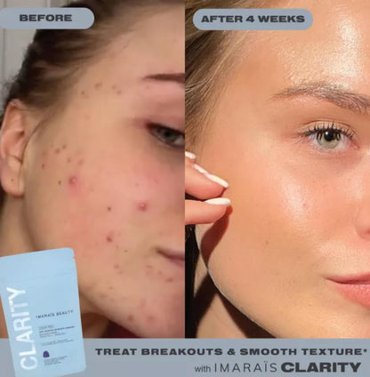 Imarais Beauty Clarity Anti-Blemish Gummies for Clear Complexion - Vegan and Sugar-Free - 30ct