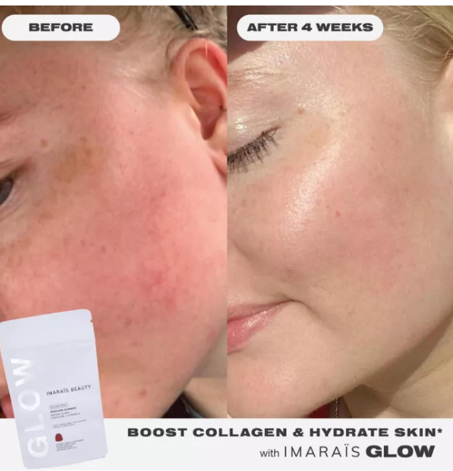 Imarais Beauty Glow Skincare Gummies for Hydration, Collagen Boosting - Vegan and Sugar-Free - 30ct: Certified Gluten-Free, Plant-Based