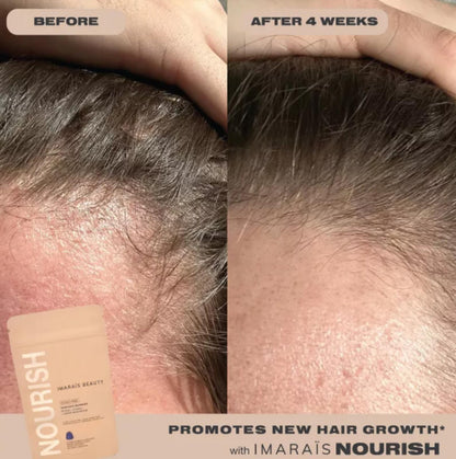 Imarais Beauty Nourish Haircare Gummies for Hair Growth, Anti-Shedding - Vegan and Sugar-Free - 30ct